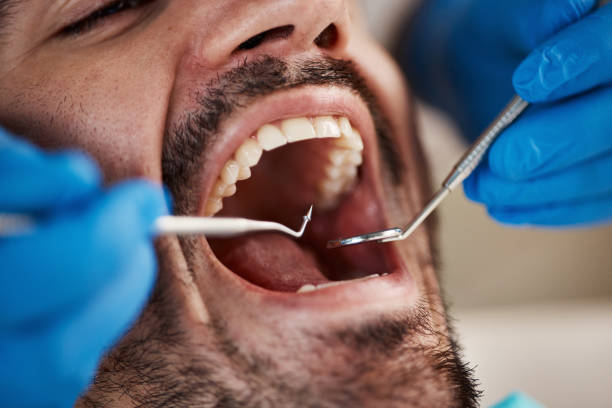 Best Emergency Dental Care for Broken or Chipped Teeth in Rogue River, OR